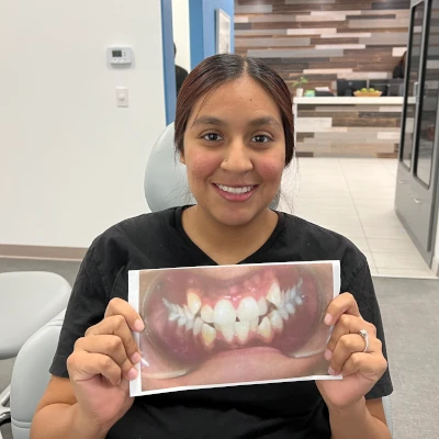 Adult Braces Before & After